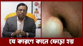 যে কারণে কানে ফোড়া হয়। Prof. Dr. Md. Abu Hanif