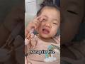 Why mosquito bit baby’ s eye!!!!!!?? #shorts #vlogs #viral