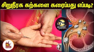 அறுவை சிகிச்சையின்றி சிறுநீரக கற்களை கரைப்பது எப்படி?  | Touch Therapy | Kidney Stones