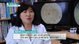 무엇이든 물어보세요 - 건조한 실내! 촉촉하게 만드는 3총사 20170222