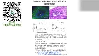 胰岛移植根治1型糖尿病，告别终身免疫抑制剂服药将成为现实。