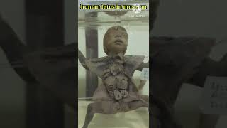 @human fetus in museum4🥺 #shorts #fetus #hearttouching