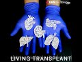 A Second Chance for Love: Emma’s Determination to Donate a Kidney at 79 | Patient Stories, Organ ...