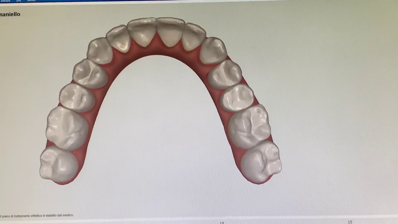 Invisalign Youtube