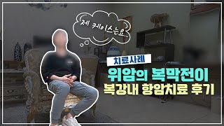 샘병원 치료사례_위암 4기 복막전이 복강내항암치료_이채영 원장(지샘병원 통합암병원장)