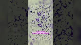 Staphylococcus aureus#shorts #trending #staphylococcus #microbiology #doctor#culture #bacteria #song