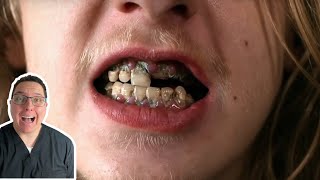 Can This 21-year-old's ROTTEN TEETH be Saved!? | Dental Student Reacts