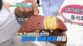 울퉁불퉁 변하는 간 주목 ‘만성간염’ [내 몸 사용설명서] 277회 20191122