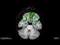 thc exposure is reflected in the microstructure of the cerebral cortex and amygdala of young adults