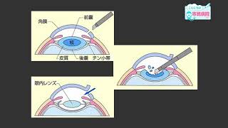 令和５年８月テレビ広報いみず【こんにちは市民病院です】