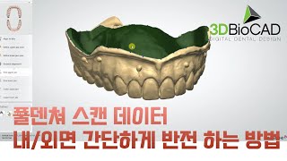 3DBioCAD - 3Shape Dentalsystem 덴쳐 스캔 파일 내면, 외면 반전 간단하게 하는 방법