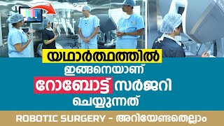 റോബോട്ടിക് സർജറിയെ കുറിച് നിങ്ങൾ അറിയേണ്ടതെല്ലാം | Robotic Surgery Malayalam