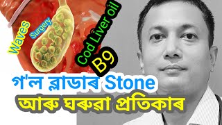 Gallbladder Stone ৰ পৰা কেনেকৈ পৰিত্ৰাণ পাব পাৰি ? | Dr. Navajit Sahu