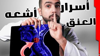 كيف تقرأ اشعه رنين الرقبه او العنق وتشخص الاعراض || Cervical MRI