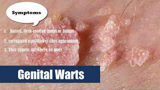 16# Genital Warts HPV  Human Papilloma Virus in Women and men symptoms