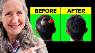 10 PROVEN Tips To RE-GROW Hair FAST - 🚫 WITHOUT Surgery! | Barbara O'neill