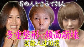 【まるで別人】多重整形で顔面崩壊した女性芸能人10選！