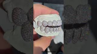 Let’s talk about different diamonds Grillz 🥶 Arianandco.com