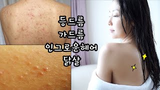 ENG) 등드름,가드름,닭살,인그로운헤어! 해결할 수 있어요 Care for body skin trouble  | 뷰티클라우드 유나 UNA