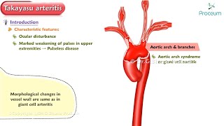 Takayasu Arteritis Pathology (Animation)