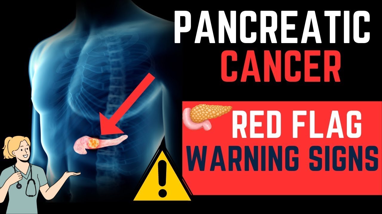 PANCREATIC CANCER | PANCREATIC CANCER SYMPTOMS | EARLY WARNING SIGNS OF ...