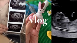 🤰🏻임신 vlog • 임신 8-12주 👶🏻, 젤리곰바니, 난임병원 졸업이라니, 분만병원 전원, 산후조리원투어, 바니와 함께한 아빠 환갑파티