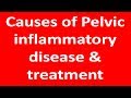 Causes of Pelvic inflammatory disease & treatment . ( DOCTOR'S TIPS )