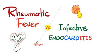Rheumatic Fever vs Infective Endocarditis - Comparison - Cardiology Series