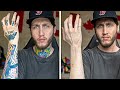 I Removed All My Tattoos