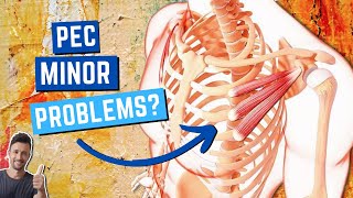 Is Your Pec Minor a Major Problem? | Here's How to Release it FOR GOOD!