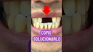 ¿Cómo se fabrica una PRÓTESIS DENTAL FLEXIBLE?