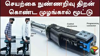 செயற்கை நுண்ணறிவு திறன் கொண்ட முழங்கால் மூட்டு