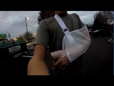 How to brake your thumb How to brake your thumb