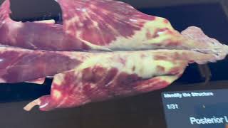 How to use anatomage to take the quiz