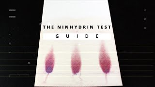 Ninhydrin Test: A Detailed Guide to The Amines and Amino Acids Determination