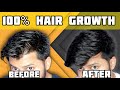 Best Hair Growth Technique | இத follow பண்ணா கண்டிப்பா முடி வளரும் | Tamil | Shadhik Azeez