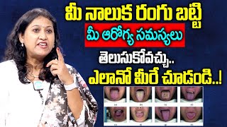 Dr Jyothsna about Different Colours of the Tongue and Their Problems | Symptoms of Mouth Infection