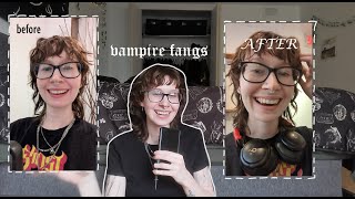 i got permanent vampire fangs! cost, shape & aftercare