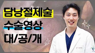 담낭제거수술! 리얼한 수술모습 확인 하세요!