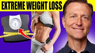 The Ultimate Fat Burning Guide: Dr. Berg's Webinar on Maximum Weight Loss