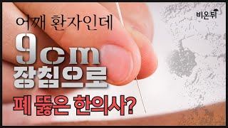 어깨 환자인데 '9cm 장침'으로 폐 뚫어 사망하게 한 한의사?