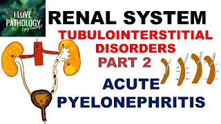 ACUTE PYELONEPHRITIS- Pathology