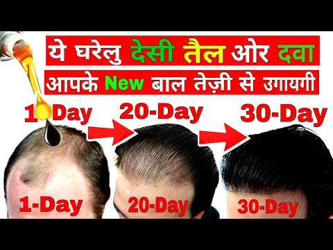 How to Stop Hair Fall Naturally | Grow Hair Faster(Men & Women) How to Stop Hair Fall Naturally | Grow Hair Faster(Men & Women)