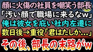 【感動する話】顔に火傷がある陰キャ社員を見下す上司「化粧くらいしろバケモノがw」彼女を庇った俺は窓際部署に社内左遷させられた。ある日→会社の重役が視察に来ると「君は確か…」俺「あ！」【泣ける話】