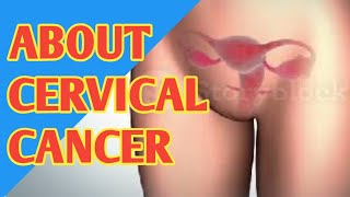 About Cervical Cancer, Types, Causes and Treatment