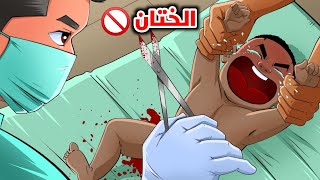 شاهد كيف تتم عملية الطهارة خطوة بخطوة (الختان)_ Circumcision procedure