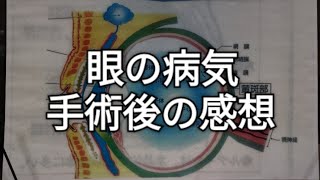 目の病気、網膜裂孔、手術後の感想、飛蚊症、網膜剥離、黄斑変性症