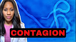 HOW CONTAGIOUS IS EBOLA? HOW FAST CAN IT SPREAD? A Doctor Explains What You Need to Know!