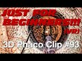 3D Phaco Clip #93 - Soft Nucleus Nice Stop & Mechanical Chop (VR Headset Version)