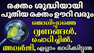 രക്തം ശുദ്ധിയാക്കാൻ ഏറ്റവും നല്ല അടുക്കള ടിപ്പ്. മാറാത്ത അലർജിയും തടിപ്പും ഇതിൽ ഒതുങ്ങും